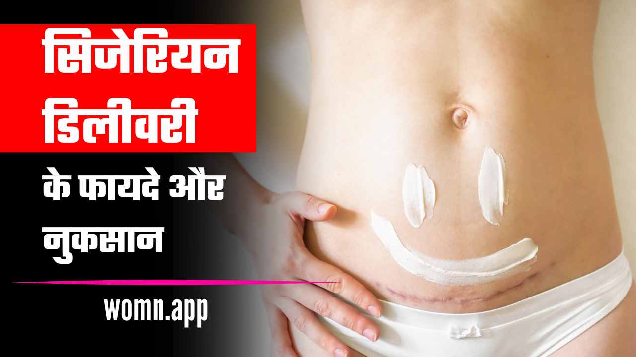 Cesarean Delivery Ke Fayde or Nuksan | सिजेरियन डिलीवरी के फायदे और नुकसान