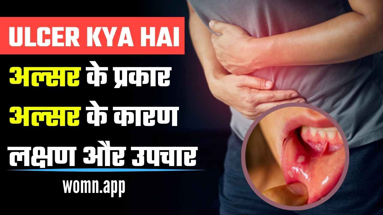 Ulcer Kya Hai? जाने अल्सर के कारण, लक्षण और उपचार